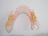 見た目を重視する方に　部分入れ歯｜即日入れ歯グループ｜アート歯科